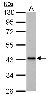 IVD Antibody - IVD antibody detects IVD protein by Western blot analysis. A. 30 ug PC-12 whole cell lysate/extract. 10 % SDS-PAGE. IVD antibody dilution:1:1000