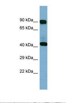 IVD Antibody - Western blot of Human Fetal Spleen. IVD antibody dilution 1.0 ug/ml.  This image was taken for the unconjugated form of this product. Other forms have not been tested.