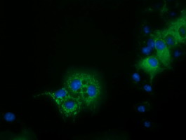 IVD Antibody - Anti-IVD mouse monoclonal antibody  immunofluorescent staining of COS7 cells transiently transfected by pCMV6-ENTRY IVD.