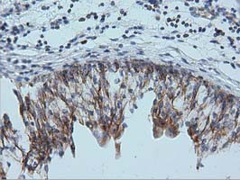 IVD Antibody - Immunohistochemical staining of paraffin-embedded Human bladder tissue within the normal limits using anti-IVD mouse monoclonal antibody  at 1:150 dilution.