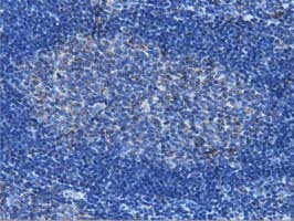 IVD Antibody - Immunohistochemical staining of paraffin-embedded Human lymph node tissue within the normal limits using anti-IVD mouse monoclonal antibody. (Heat-induced epitope retrieval by 10mM citric buffer, pH6.0, 100C for 10min, Dilution 1:50)