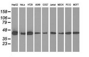 IVD Antibody - Western blot analysis of extracts. (35ug) from 9 different cell lines by using anti-IVD monoclonal antibody.
