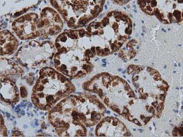IVD Antibody - Immunohistochemical staining of paraffin-embedded Human Kidney tissue within the normal limits using anti-IVD mouse monoclonal antibody  at 1:150 dilution.