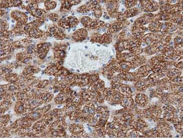 IVD Antibody - Immunohistochemical staining of paraffin-embedded Human liver tissue within the normal limits using anti-IVD mouse monoclonal antibody  at 1:150 dilution.