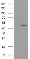 IVD Antibody - HEK293T cells were transfected with the pCMV6-ENTRY control. (Left lane) or pCMV6-ENTRY IVD. (Right lane) cDNA for 48 hrs and lysed