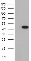 IVD Antibody - HEK293T cells were transfected with the pCMV6-ENTRY control. (Left lane) or pCMV6-ENTRY IVD. (Right lane) cDNA for 48 hrs and lysed