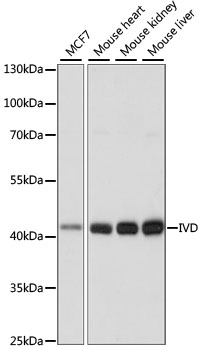 IVD Antibody - Western blot analysis of extracts of various cell lines, using IVD antibody at 1:1000 dilution. The secondary antibody used was an HRP Goat Anti-Rabbit IgG (H+L) at 1:10000 dilution. Lysates were loaded 25ug per lane and 3% nonfat dry milk in TBST was used for blocking. An ECL Kit was used for detection and the exposure time was 1S.