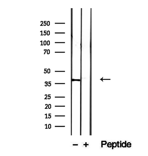 IVD Antibody - Western blot analysis of extracts of MCF-7 cells using IVD antibody.