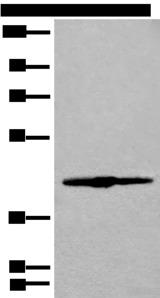 IVD Antibody - Western blot analysis of 293T cell lysate  using IVD Polyclonal Antibody at dilution of 1:500