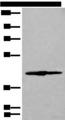 IVD Antibody - Western blot analysis of 293T cell lysate  using IVD Polyclonal Antibody at dilution of 1:500