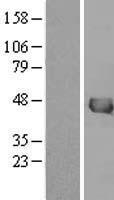 IVD Protein - Western validation with an anti-DDK antibody * L: Control HEK293 lysate R: Over-expression lysate