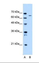 IVL / Involucrin Antibody - Lane A: Marker. Lane B: HepG2 cell lysate. Antibody concentration: 0.5 ug/ml. Gel concentration: 12%.  This image was taken for the unconjugated form of this product. Other forms have not been tested.