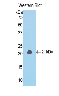 IVL / Involucrin Antibody - Western blot of recombinant IVL / Involucrin.  This image was taken for the unconjugated form of this product. Other forms have not been tested.