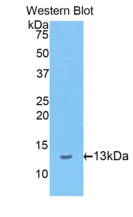 IVL / Involucrin Antibody - Western blot of recombinant IVL / Involucrin.  This image was taken for the unconjugated form of this product. Other forms have not been tested.