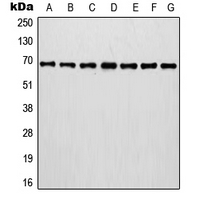 IVL / Involucrin Antibody - Western blot analysis of Involucrin expression in MCF7 (A); A375 (B); A431 (C); NIH3T3 (D); HT1080 (E); mouse brain (F); rat brain (G) whole cell lysates.