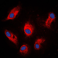 IVL / Involucrin Antibody - Immunofluorescent analysis of Involucrin staining in MCF7 cells. Formalin-fixed cells were permeabilized with 0.1% Triton X-100 in TBS for 5-10 minutes and blocked with 3% BSA-PBS for 30 minutes at room temperature. Cells were probed with the primary antibody in 3% BSA-PBS and incubated overnight at 4 C in a humidified chamber. Cells were washed with PBST and incubated with a DyLight 594-conjugated secondary antibody (red) in PBS at room temperature in the dark. DAPI was used to stain the cell nuclei (blue).