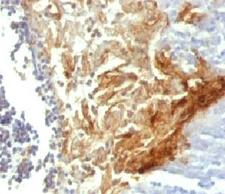 IVL / Involucrin Antibody - IHC testing of FFPE human tonsil with Involucrin antibody (clone INVO49).  This image was taken for the unmodified form of this product. Other forms have not been tested.