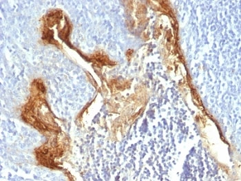 IVL / Involucrin Antibody - Formalin-fixed, paraffin-embedded human tonsil stained with Involucrin antibody (IVRN/827).  This image was taken for the unmodified form of this product. Other forms have not been tested.