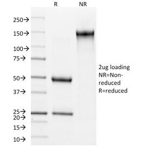 IVL / Involucrin Antibody - SDS-PAGE Analysis of Purified, BSA-Free Involucrin Antibody (clone SY5). Confirmation of Integrity and Purity of the Antibody.