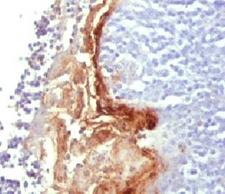 IVL / Involucrin Antibody - IHC analysis of FFPE human tonsil tissue and Involucrin antibody (clone SY5). This image was taken for the unmodified form of this product. Other forms have not been tested.