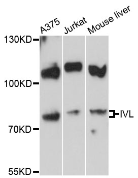 IVL / Involucrin Antibody - Western blot analysis of extracts of various cell lines.