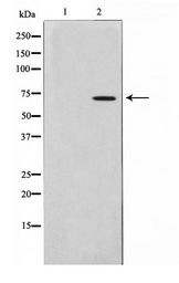 IVL / Involucrin Antibody - Western blot of HUVEC cell lysate using Involucrin Antibody