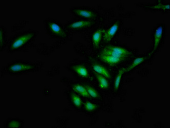 IVL / Involucrin Antibody - Immunofluorescent analysis of Hela cells at a dilution of 1:100 and Alexa Fluor 488-congugated AffiniPure Goat Anti-Rabbit IgG(H+L)