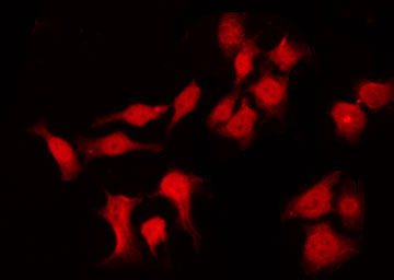 IVL / Involucrin Antibody - Staining HuvEc cells by IF/ICC. The samples were fixed with PFA and permeabilized in 0.1% Triton X-100, then blocked in 10% serum for 45 min at 25°C. The primary antibody was diluted at 1:200 and incubated with the sample for 1 hour at 37°C. An Alexa Fluor 594 conjugated goat anti-rabbit IgG (H+L) Ab, diluted at 1/600, was used as the secondary antibody.