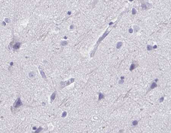 IVL / Involucrin Antibody - IHC analysis of mouse brain tissue.