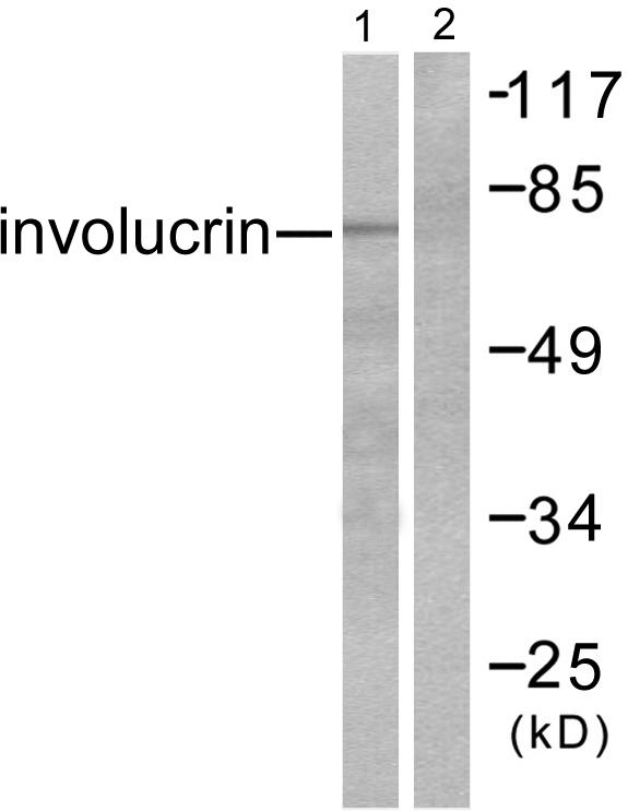 IVL / Involucrin Antibody - Western blot analysis of extracts from HuvEc cells, using Involucrin antibody.