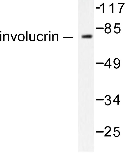 IVL / Involucrin Antibody - Western blot of Involucrin (P568) pAb in extracts from HUVEC cells.