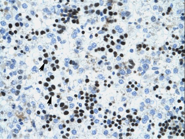 IVNS1ABP / NS1-BP Antibody - IVNS1ABP antibody ARP33099_P050-NP_006460-IVNS1ABP (influenza virus NS1A binding protein) Antibody was used in IHC to stain formalin-fixed, paraffin-embedded human liver.  This image was taken for the unconjugated form of this product. Other forms have not been tested.
