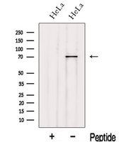 IVNS1ABP / NS1-BP Antibody - Western blot analysis of extracts of HeLa cells using IVNS1ABP antibody. The lane on the left was treated with blocking peptide.