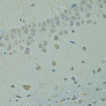 IVNS1ABP / NS1-BP Antibody - Immunohistochemistry of paraffin-embedded Rat brain using IVNS1ABP Polyclonal Antibody at dilution of 1:100 (40x lens).