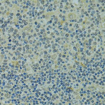 IVNS1ABP / NS1-BP Antibody - Immunohistochemistry of paraffin-embedded Human tonsil using IVNS1ABP Polyclonal Antibody at dilution of 1:100 (40x lens).