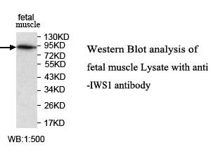 IWS1 Antibody