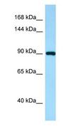 IWS1 Antibody - IWS1 antibody Western Blot of Human Kidney.  This image was taken for the unconjugated form of this product. Other forms have not been tested.