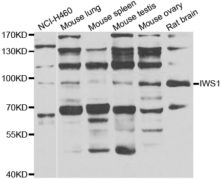 IWS1 Antibody - Western blot analysis of extracts of various cell lines.