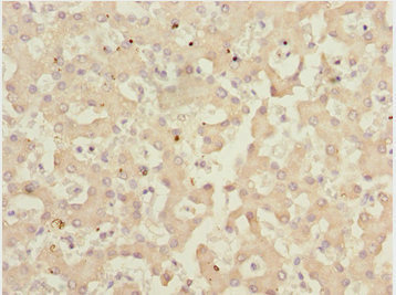 IWS1 Antibody - Immunohistochemistry of paraffin-embedded human liver tissue at dilution 1:100
