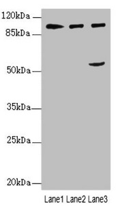 IWS1 Antibody - Western blot All Lanes:IWS1 antibody at 3.84ug/ml Lane 1 : Hela whole cell lysate Lane 2 : 293T whole cell lysate Lane 3 : Jurkat whole cell lysate Secondary Goat polyclonal to Rabbit IgG at 1/10000 dilution Predicted band size: 92,57,70 kDa Observed band size: 92,57 kDa