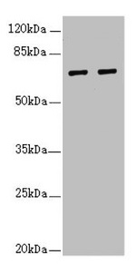 IWS1 Antibody - Western blot All lanes: IWS1 antibody at 3.84µg/ml Lane 1: 293T whole cell lysate Lane 2: Jurkat whole cell lysate Secondary Goat polyclonal to rabbit IgG at 1/10000 dilution Predicted band size: 92, 57, 70 kDa Observed band size: 70 kDa
