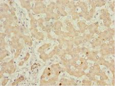 IWS1 Antibody - Immunohistochemistry of paraffin-embedded human liver tissue at dilution 1:100