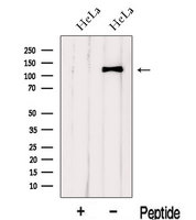 IWS1 Antibody - Western blot analysis of extracts of HeLa cells using IWS1 antibody. The lane on the left was treated with blocking peptide.