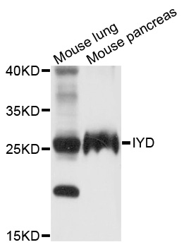 IYD Antibody - Western blot analysis of extracts of various cell lines.