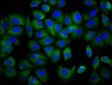 IYD Antibody - Immunofluorescence staining of A549 cells diluted at 1:166, counter-stained with DAPI. The cells were fixed in 4% formaldehyde, permeabilized using 0.2% Triton X-100 and blocked in 10% normal Goat Serum. The cells were then incubated with the antibody overnight at 4°C.The Secondary antibody was Alexa Fluor 488-congugated AffiniPure Goat Anti-Rabbit IgG (H+L).
