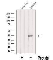 IYD Antibody - Western blot analysis of extracts of human liver tissue using IYD antibody. The lane on the left was treated with blocking peptide.