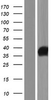 IYD Protein - Western validation with an anti-DDK antibody * L: Control HEK293 lysate R: Over-expression lysate