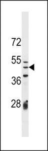 IZUMO1 / IZUMO Antibody - IZUM1 Antibody western blot of CEM cell line lysates (35 ug/lane). The IZUM1 antibody detected the IZUM1 protein (arrow).