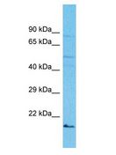 IZUMO2 Antibody - IZUMO2 antibody Western Blot of OVCAR-3. Antibody dilution: 1 ug/ml.  This image was taken for the unconjugated form of this product. Other forms have not been tested.