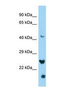 IZUMO4 Antibody - IZUMO4 antibody Western blot of HepG2 Cell lysate. Antibody concentration 1 ug/ml.  This image was taken for the unconjugated form of this product. Other forms have not been tested.